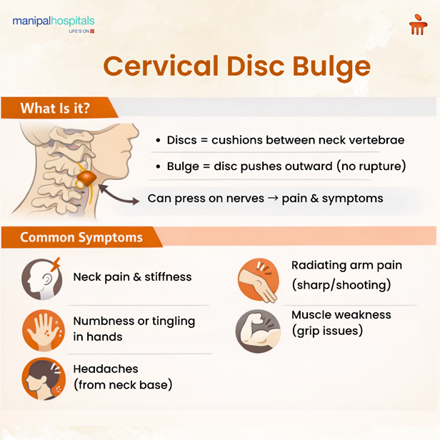 cervical disc bulge